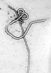Gambar virus ebola