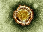 gamabaran mikroskopis Virus Corona