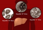 virus Hepatitis